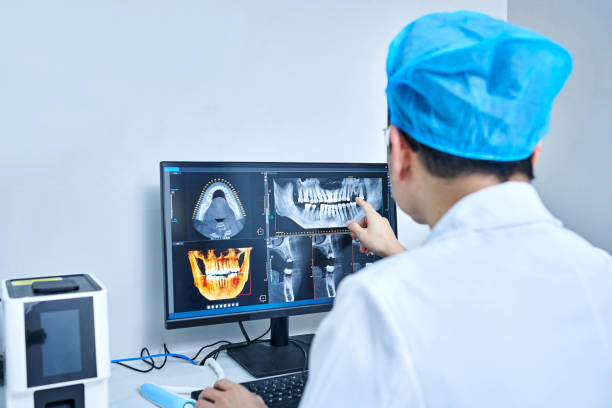 Best Emergency Dentist for Lost Fillings or Crowns in Port Byron, NY